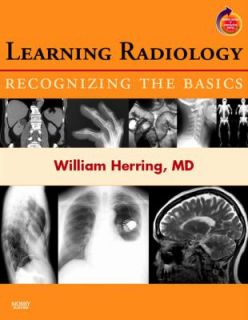 Learning Radiology Recognizing the Basics   With Student Consult 