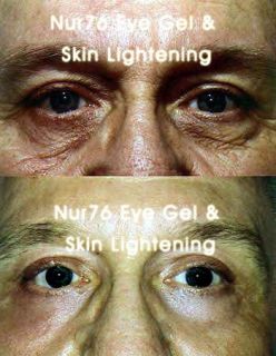NUR76 Fade Out Under Eye Circles Dark Bags Eyes Nur 76