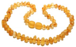 Genuine Raw Baltic Amber Baby Teething Necklace Unpolished