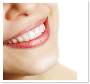   Strength 44 Carbamide Peroxide 5ml Teeth Whitening Gel Refil