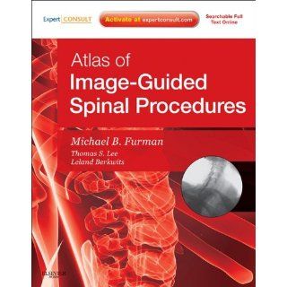 Image Atlas of Image Guided Spinal Procedures Michael Bruce Furman