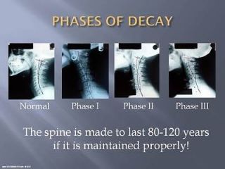 THE CHIROPRACTIC REPORT OF FINDINGS POWERPOINT LECTURE   SEE300AWEEK